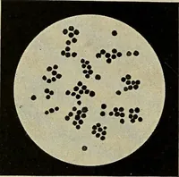 An illustration from Grundriss und Atlas der allgemeinen Chirurgie (1905)