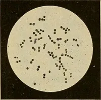 An illustration from Grundriss und Atlas der allgemeinen Chirurgie (1905)