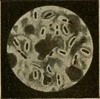 An illustration from Grundriss und Atlas der allgemeinen Chirurgie (1905)