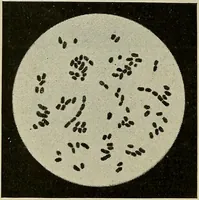Picture 57 of 110 from Grundriss und Atlas der allgemeinen Chirurgie (1905), leaf 214