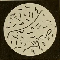 Picture 58 of 110 from Grundriss und Atlas der allgemeinen Chirurgie (1905), leaf 215