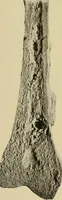 Picture 59 of 110 from Grundriss und Atlas der allgemeinen Chirurgie (1905), leaf 269