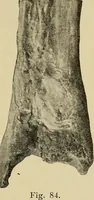 Picture 60 of 110 from Grundriss und Atlas der allgemeinen Chirurgie (1905), leaf 275