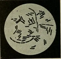 An illustration from Grundriss und Atlas der allgemeinen Chirurgie (1905)