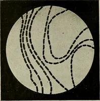 An illustration from Grundriss und Atlas der allgemeinen Chirurgie (1905)