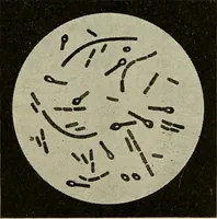Picture 65 of 110 from Grundriss und Atlas der allgemeinen Chirurgie (1905), leaf 310