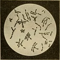 Picture 66 of 110 from Grundriss und Atlas der allgemeinen Chirurgie (1905), leaf 317