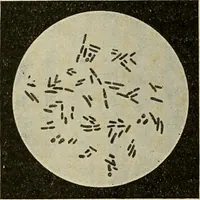 Picture 67 of 110 from Grundriss und Atlas der allgemeinen Chirurgie (1905), leaf 326