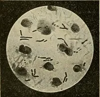Picture 68 of 110 from Grundriss und Atlas der allgemeinen Chirurgie (1905), leaf 328