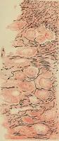 Picture 70 of 110 from Grundriss und Atlas der allgemeinen Chirurgie (1905), leaf 331