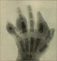 An illustration from Grundriss und Atlas der allgemeinen Chirurgie (1905)