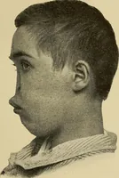 An illustration from Grundriss und Atlas der allgemeinen Chirurgie (1905)