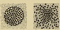 Picture 78 of 110 from Grundriss und Atlas der allgemeinen Chirurgie (1905), leaf 379