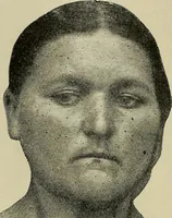 An illustration from Grundriss und Atlas der allgemeinen Chirurgie (1905)