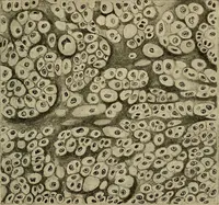 An illustration from Grundriss und Atlas der allgemeinen Chirurgie (1905)