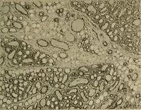 Picture 83 of 116 from Grundriss und Atlas der allgemeinen Chirurgie (1905), leaf 401