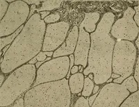 Picture 83 of 110 from Grundriss und Atlas der allgemeinen Chirurgie (1905), leaf 401