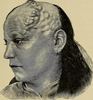 An illustration from Grundriss und Atlas der allgemeinen Chirurgie (1905)