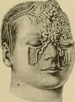 An illustration from Grundriss und Atlas der allgemeinen Chirurgie (1905)