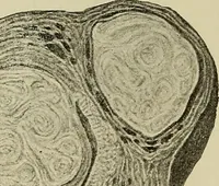 An illustration from Grundriss und Atlas der allgemeinen Chirurgie (1905)