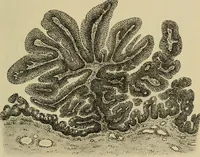 An illustration from Grundriss und Atlas der allgemeinen Chirurgie (1905)