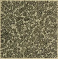 Picture 91 of 110 from Grundriss und Atlas der allgemeinen Chirurgie (1905), leaf 419
