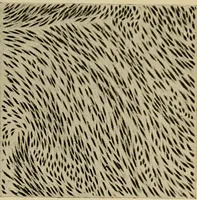 An illustration from Grundriss und Atlas der allgemeinen Chirurgie (1905)