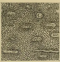 Picture 93 of 110 from Grundriss und Atlas der allgemeinen Chirurgie (1905), leaf 421