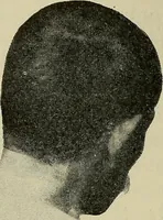 An illustration from Grundriss und Atlas der allgemeinen Chirurgie (1905)