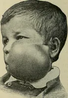 Picture 97 of 110 from Grundriss und Atlas der allgemeinen Chirurgie (1905), leaf 426