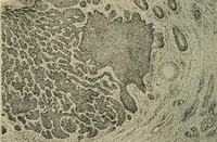 An illustration from Grundriss und Atlas der allgemeinen Chirurgie (1905)