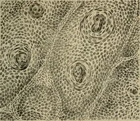 An illustration from Grundriss und Atlas der allgemeinen Chirurgie (1905)