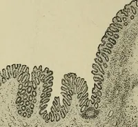 An illustration from Grundriss und Atlas der allgemeinen Chirurgie (1905)