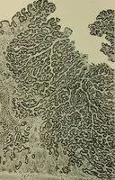 An illustration from Grundriss und Atlas der allgemeinen Chirurgie (1905)