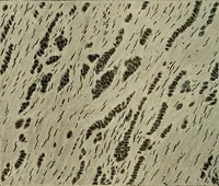 Picture 105 of 116 from Grundriss und Atlas der allgemeinen Chirurgie (1905), leaf 440