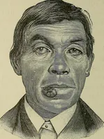 An illustration from Grundriss und Atlas der allgemeinen Chirurgie (1905)