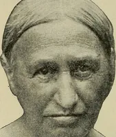 An illustration from Grundriss und Atlas der allgemeinen Chirurgie (1905)
