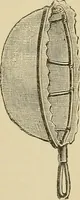 An illustration from Grundriss und Atlas der allgemeinen Chirurgie (1905)
