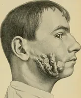 Picture 115 of 116 from Grundriss und Atlas der allgemeinen Chirurgie (1905), leaf 501