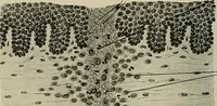 An illustration from Grundriss und Atlas der allgemeinen Chirurgie (1905)