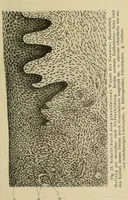 An illustration from Grundriss und Atlas der allgemeinen Chirurgie (1905)