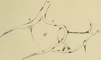 An illustration from Grundriss und Atlas der allgemeinen Chirurgie (1905)