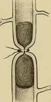 An illustration from Grundriss und Atlas der allgemeinen Chirurgie (1905)