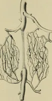An illustration from Grundriss und Atlas der allgemeinen Chirurgie (1905)