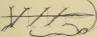 An illustration from Grundriss und Atlas der allgemeinen Chirurgie (1905)