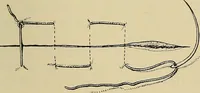 An illustration from Grundriss und Atlas der allgemeinen Chirurgie (1905)
