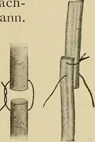 An illustration from Grundriss und Atlas der allgemeinen Chirurgie (1905)