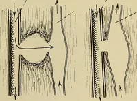 An illustration from Grundriss und Atlas der allgemeinen Chirurgie (1905)