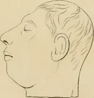 An illustration from Grundzüge der Phrenologie; oder, Anleitung zum Studium dieser Wissenschaft (1842)