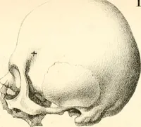 Picture 13 of 27 from Grundzüge der Phrenologie; oder, Anleitung zum Studium dieser Wissenschaft, mit Berücksichtigung der neueren Forschungen auf dem Gebiete der Physiologie und Psychologie (1856), leaf 622